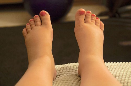 Phù chân khi mang thai là gì? Có nguy hiểm không khi nào thì cần đi khám bác sĩ